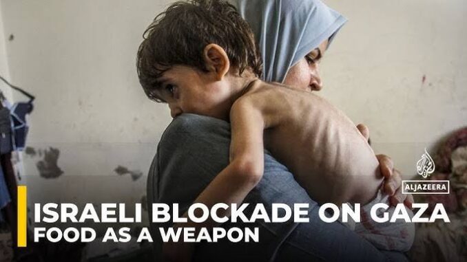 A mother holds her malnourished child amid crisis. A mother holds her malnourished child amid crisis.